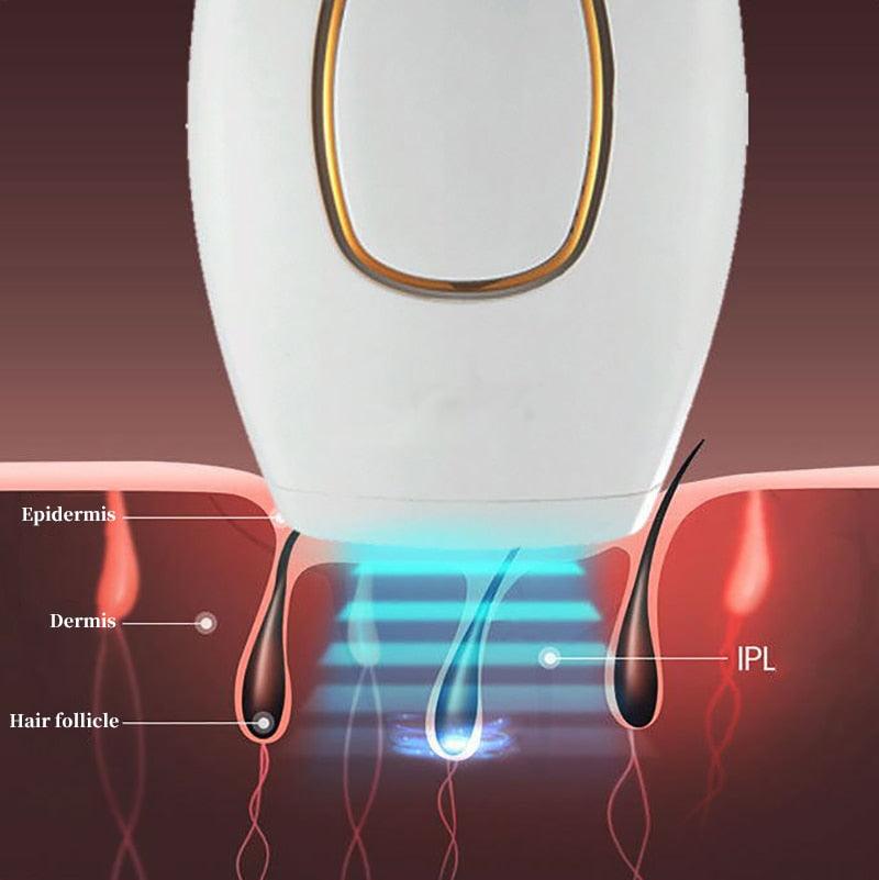 Depilador a Laser Definitivo Importado/LaserDepil - lojaluarshop